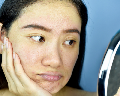 Pores & Blackheads - Tailored Skincare Routines - Understanding Pores & Blackheads